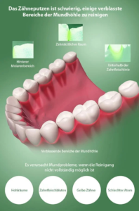 Dental Water Flosser